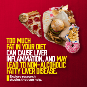 Too much fat in your diet can cause liver inflammation and may lead to NAFLD