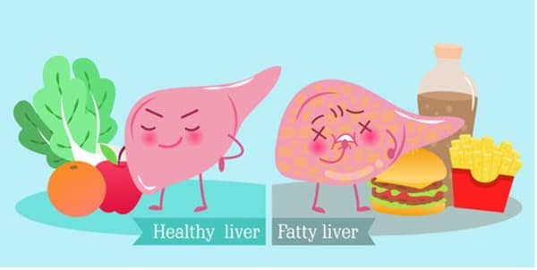 Cartoon image comparing healthy and unhealthy liver.
